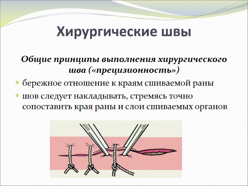 Хирургические швы Общие принципы выполнения хирургического шва («прецизионность») бережное отношение к краям сшиваемой раны Хирургические швы Общие принципы выполнения хирургического шва («прецизионность») бережное отношение к краям сшиваемой раны